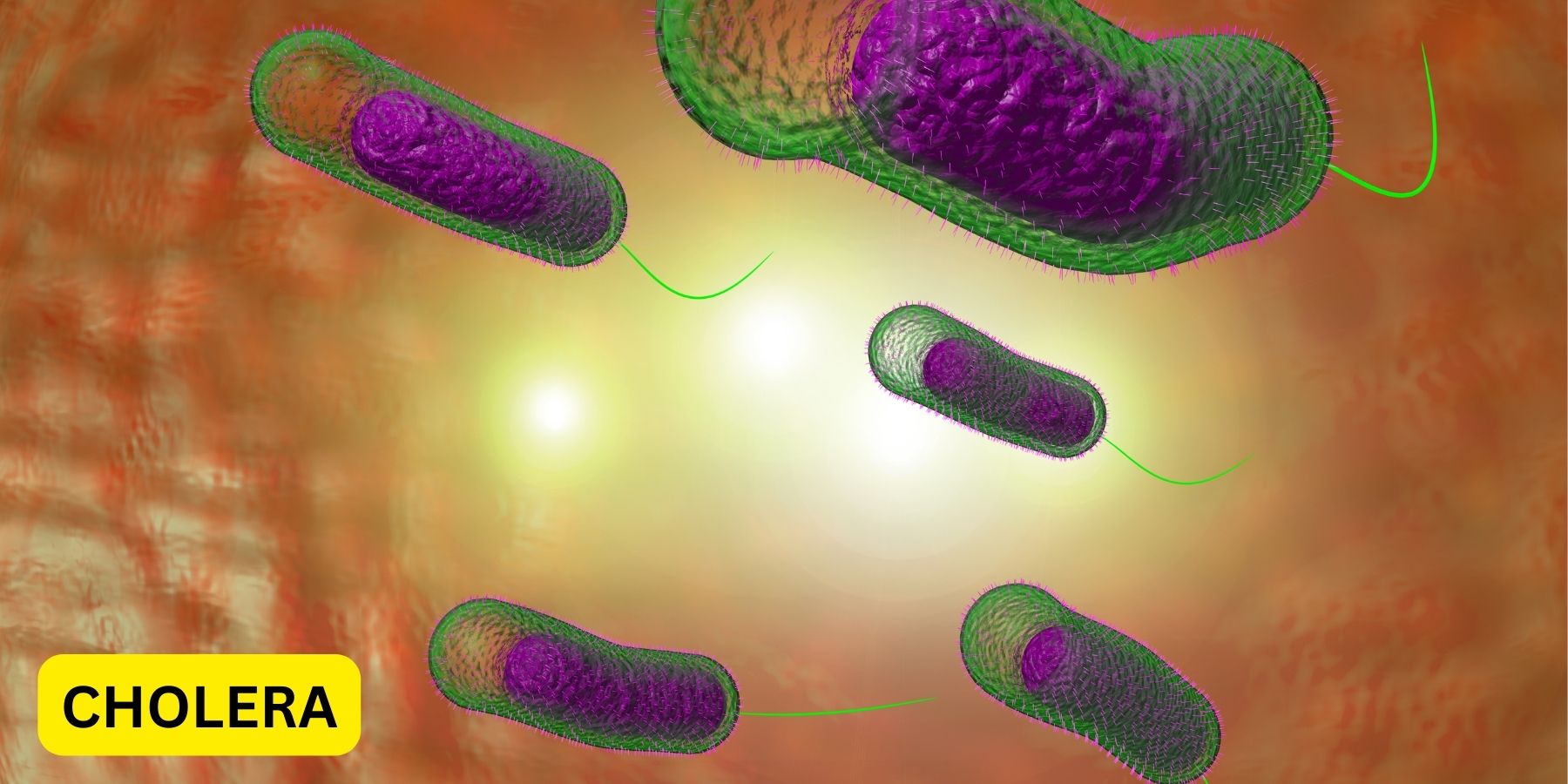Cholera Outbreak Claims 4 Lives In Plateau