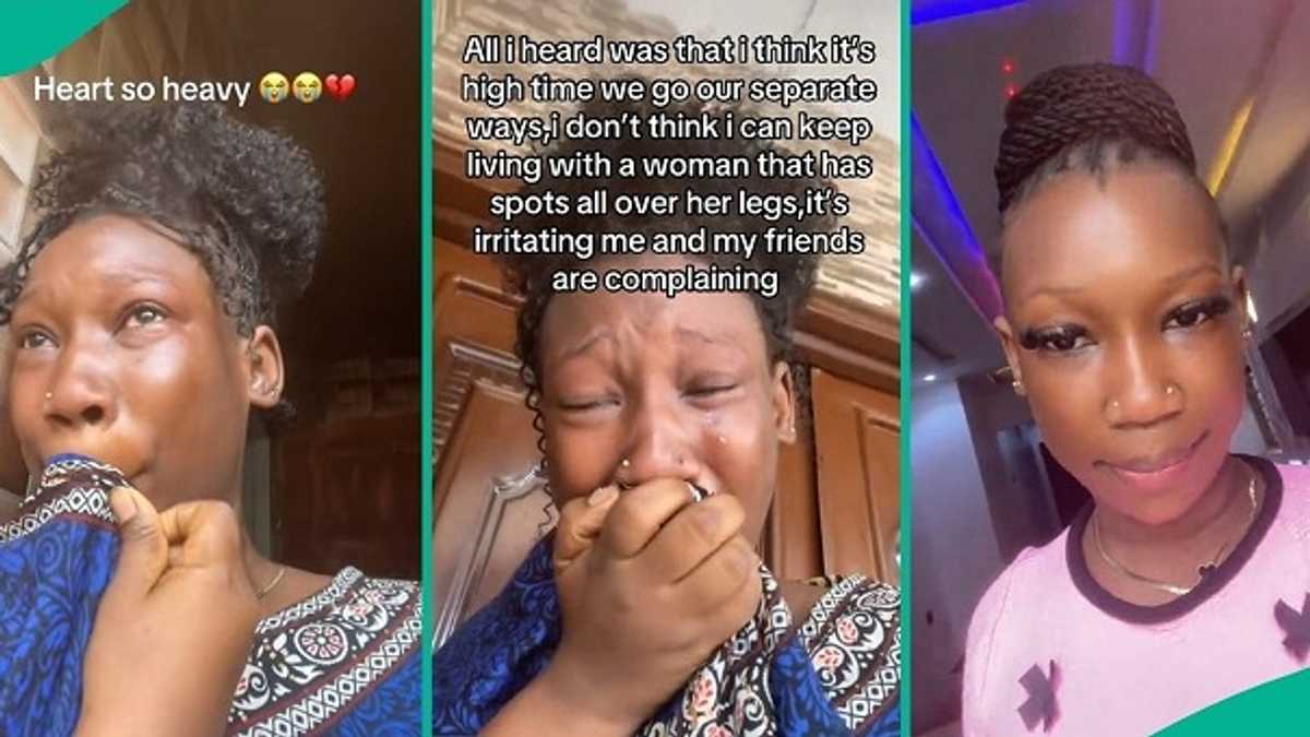 "My Friends are Complaining": Man Quits Marriage as Wife Develops Spots on Her Legs, People React